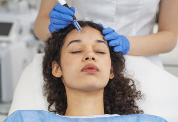 Microneedling